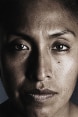 Visage d’une femme violentée.
