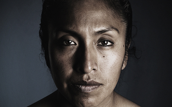 Gesicht einer gewaltbetroffenen Frau.