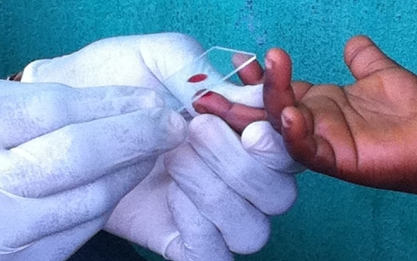Deux mains gantées de blanc prélèvent du sang de la main d’un enfant.