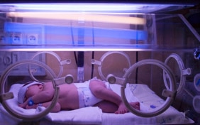 A newborn under a fluorescent lamp